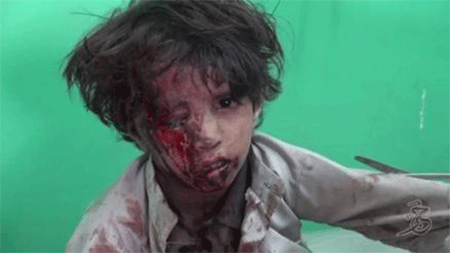 la infancia inocente frente a la salvaje agresión saudí Arabia Saudita expande sus masacres en Yemen